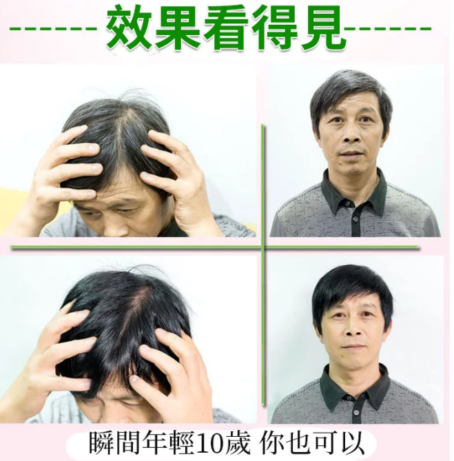 植物染髮，洗一次黑一年，完全遮蓋白頭髮，只黑頭髮，不黑頭皮，安全無毒不過敏。