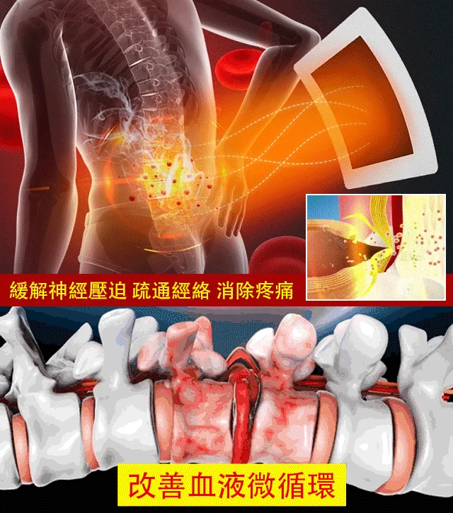 火爆熱銷中!坐骨神經腰間盤關節頸肩腰腿半月貼！1盒10貼,無任何副作用!